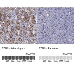 StAR Antibody, Novus Biologicals 25 &mu;L; Unlabeled:Antibodies, Polyclonal